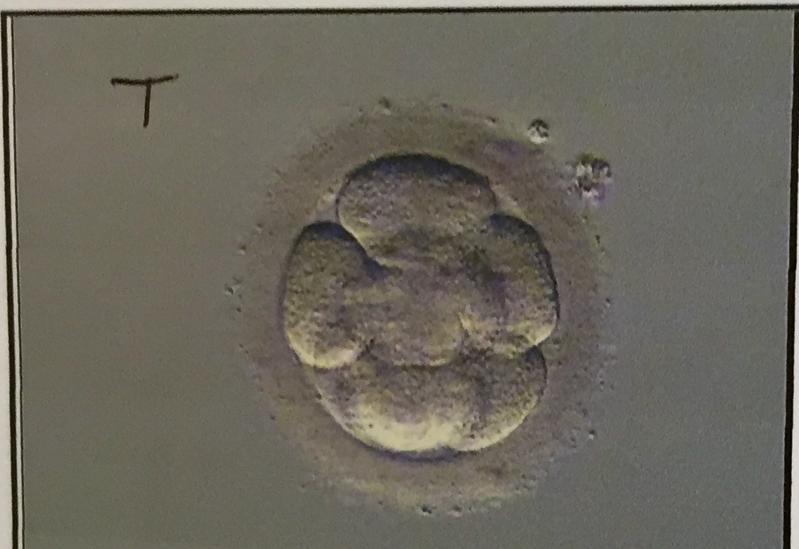 Day 3 Embryo Transfer and the Waiting Game Our Science Baby