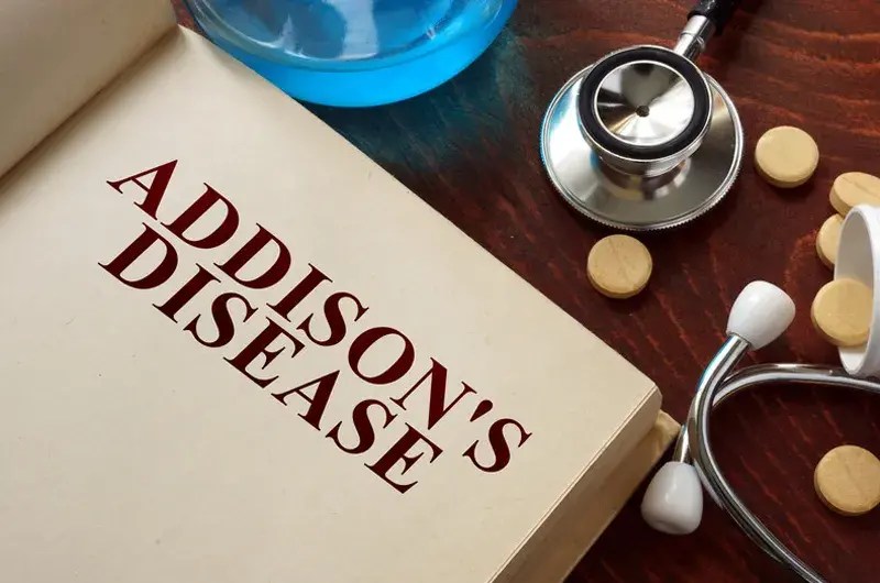 How to Code for Addison's Disease Using ICD10 Medical Codes