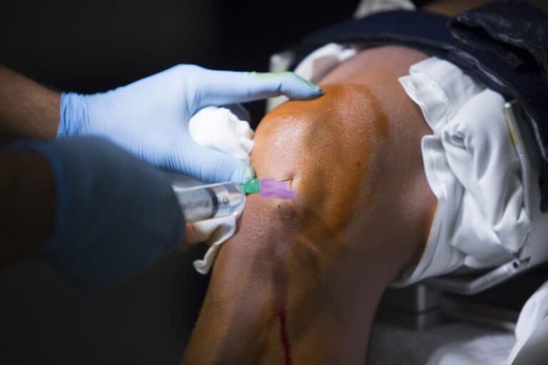 Medical Billing and Coding Arthroscopic Knee Surgery