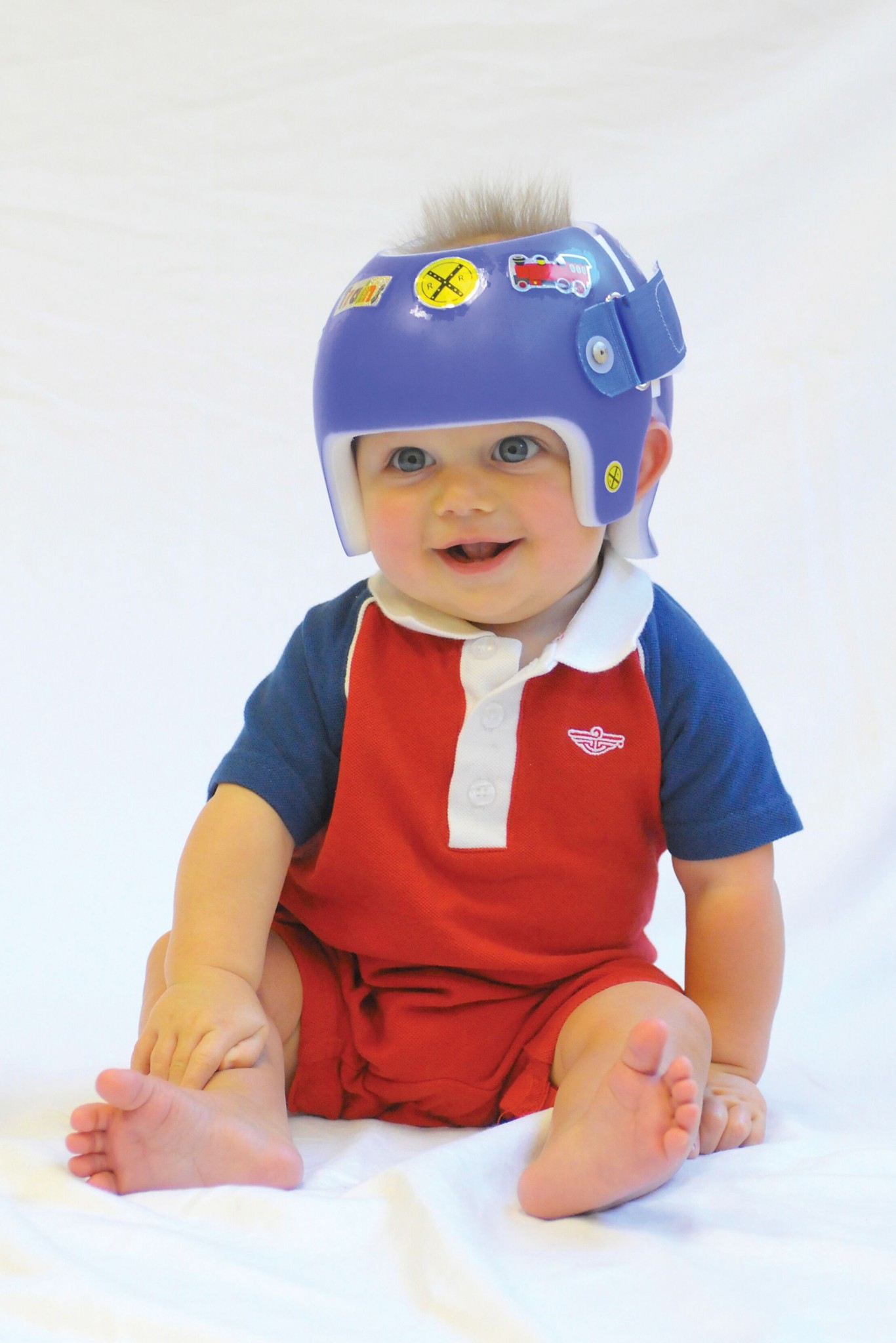 Owens Carolina is your pediatric cranial molding helmet specialist