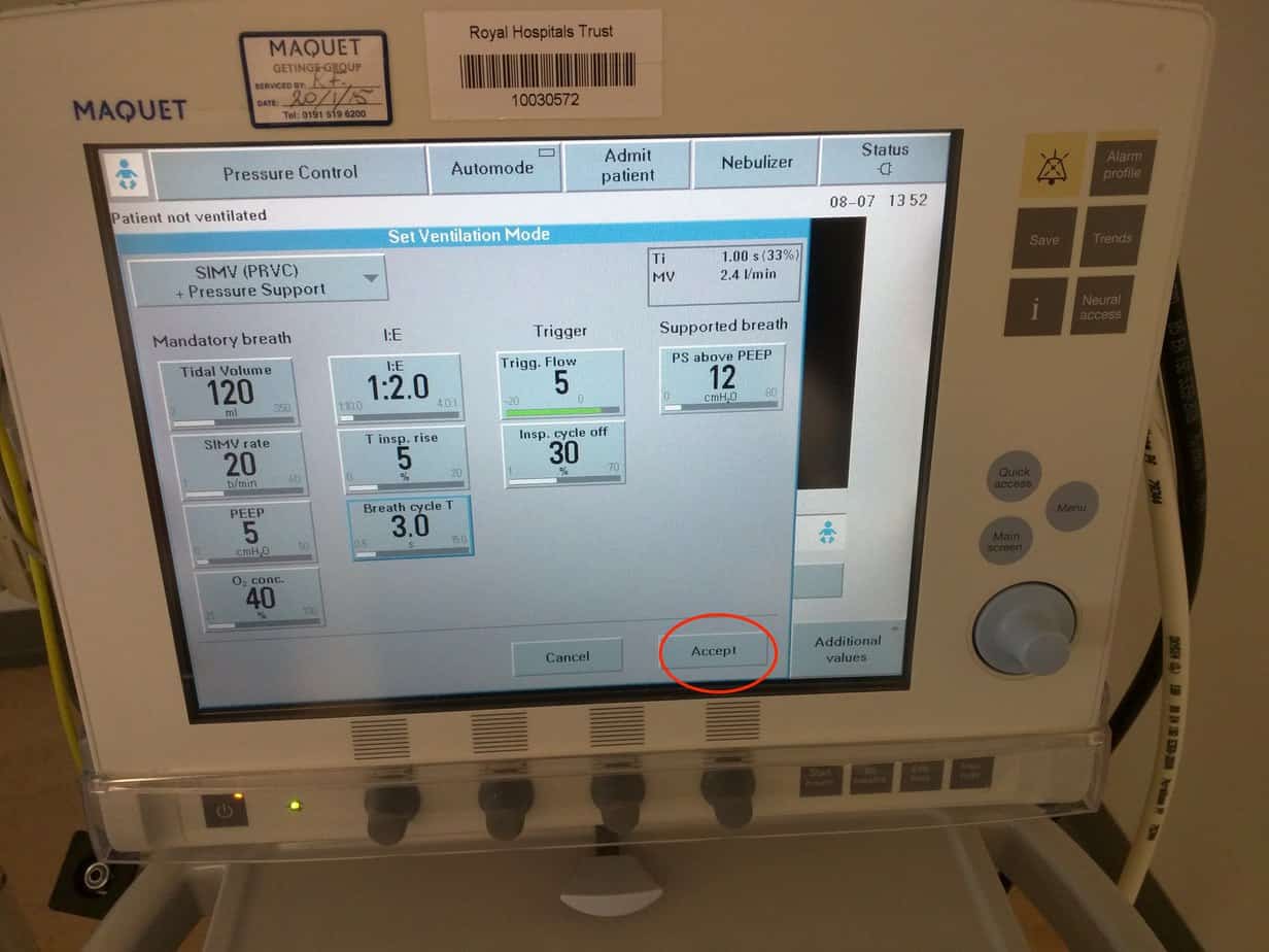 Setting up the Ventilator Paediatric Emergencies