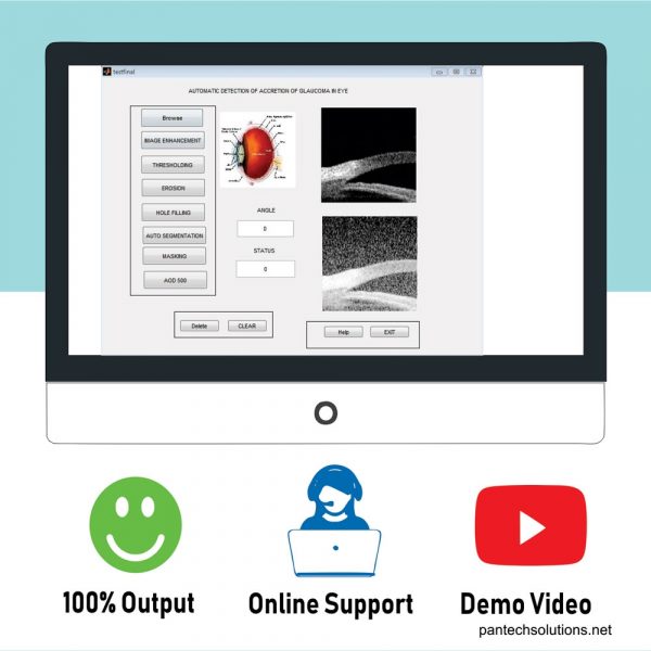 Matlab code for Detection Pantech.AI