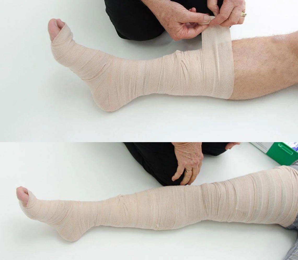 Snake Bite First Aid What to do if bitten by a snake