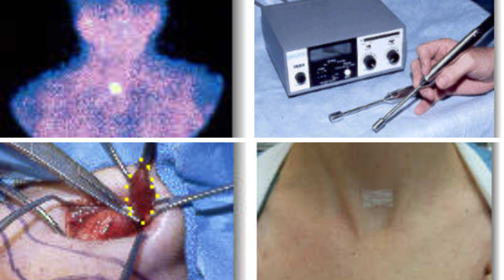 The Best Hospital for Parathyroid Surgery