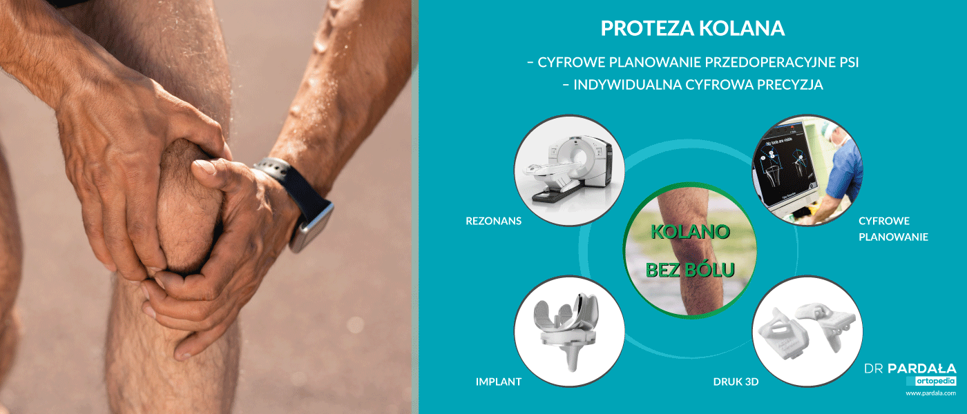 Kolana i protezy elektroniczne – Protezy kończyn Proteza nogi.
