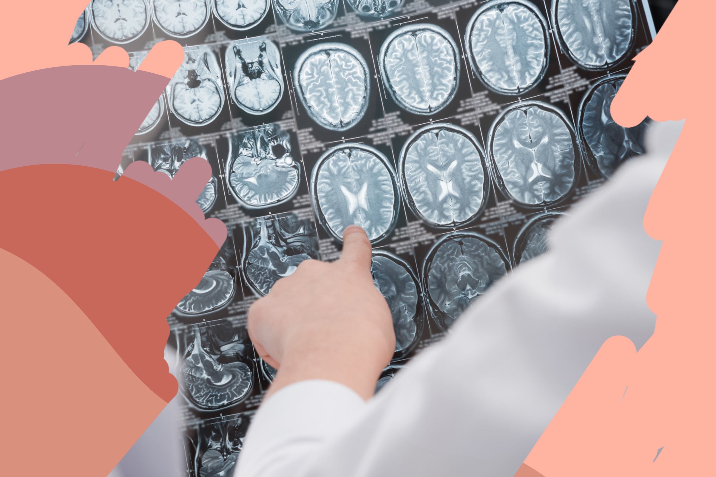 How Does Trauma Affect The Brain In Children