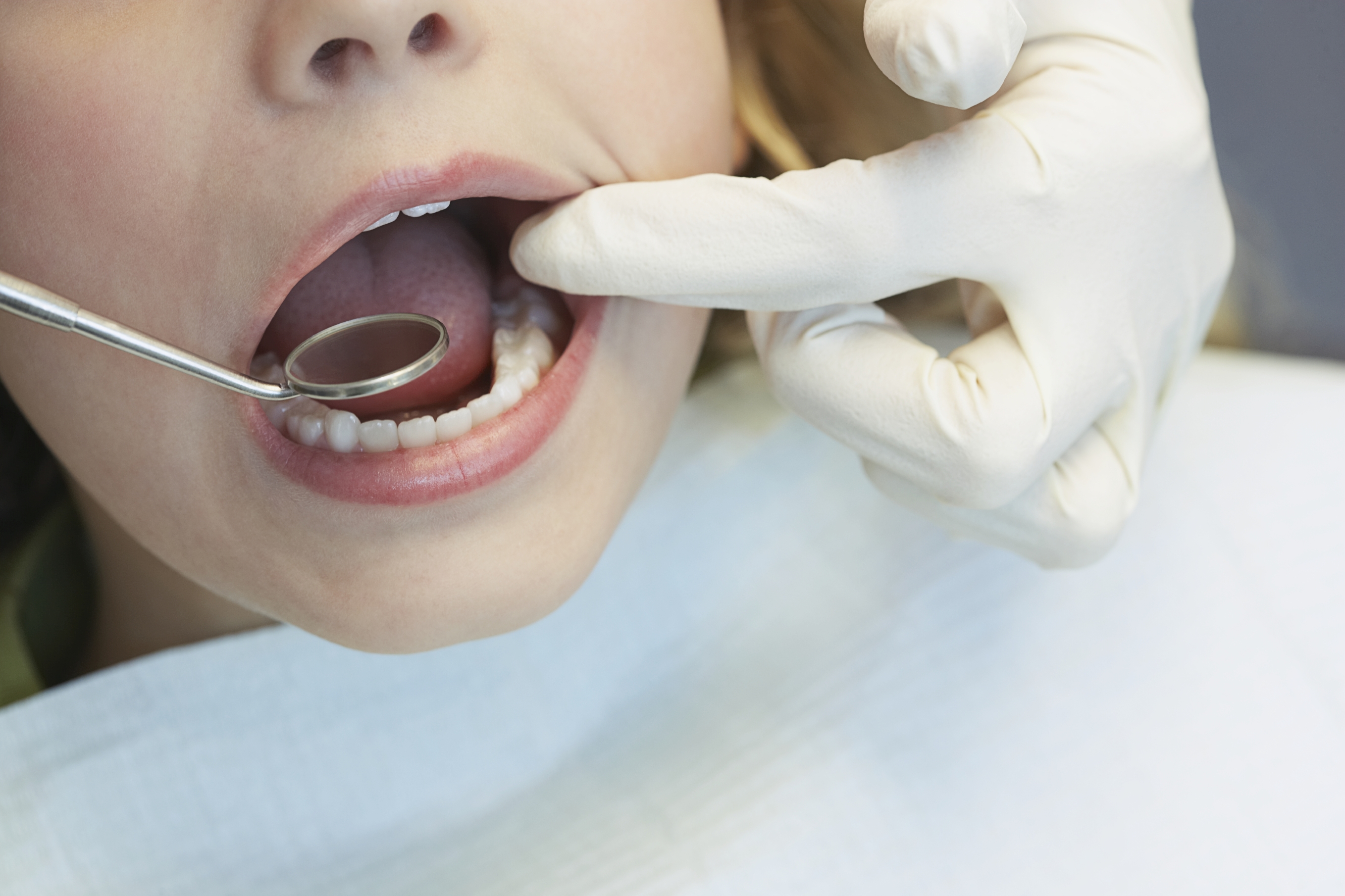 Banking on Baby Teeth Dental Stem Cells and Regenerative Therapies