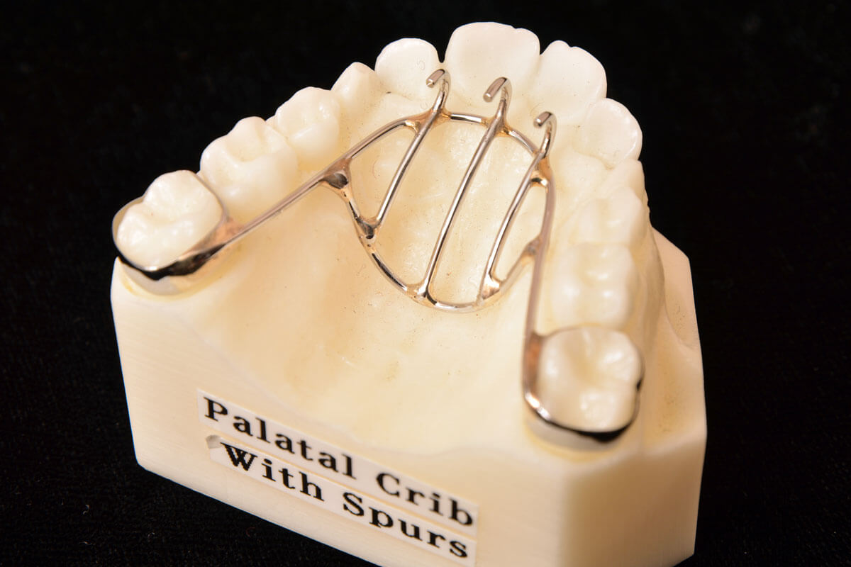 Expansion and Arch Development Parklund Orthodontic Lab