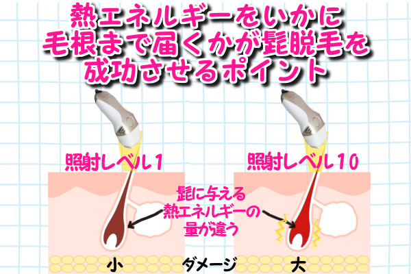 毛が生えてくる！ケノンでの髭脱毛のやり方と効果的な正しい使い方