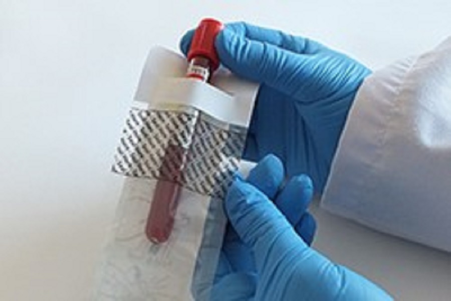 Costeffective and userfriendly specimen biopouch