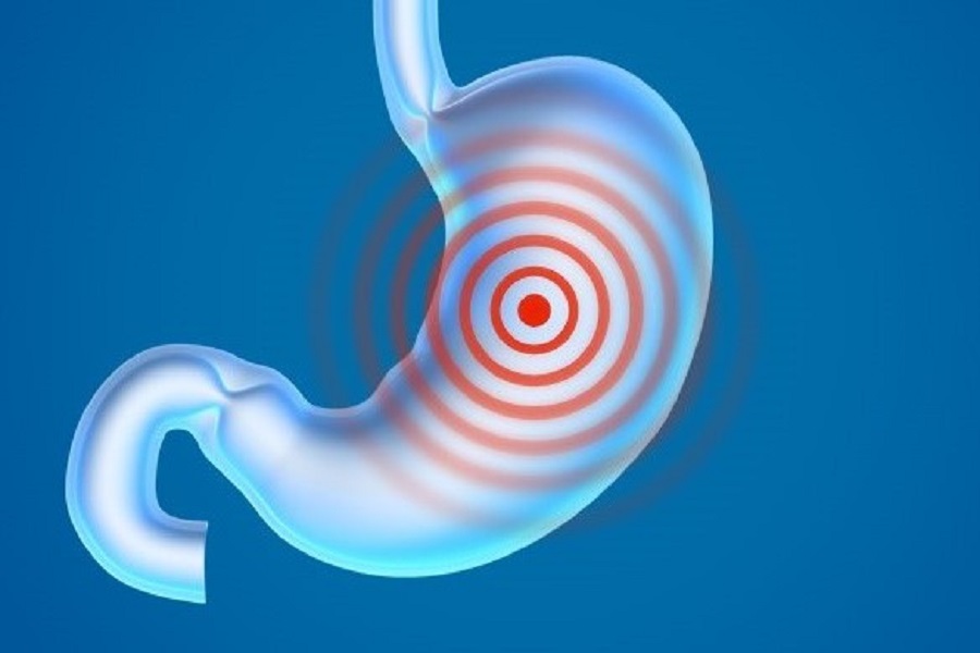 Test panel for stomach health backed by further evidence