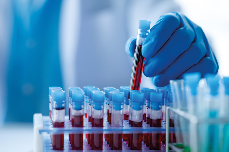 Blood culture preanalytical KPIs The next challenge in microbiology?