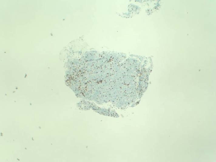 Pathology Outlines CD3