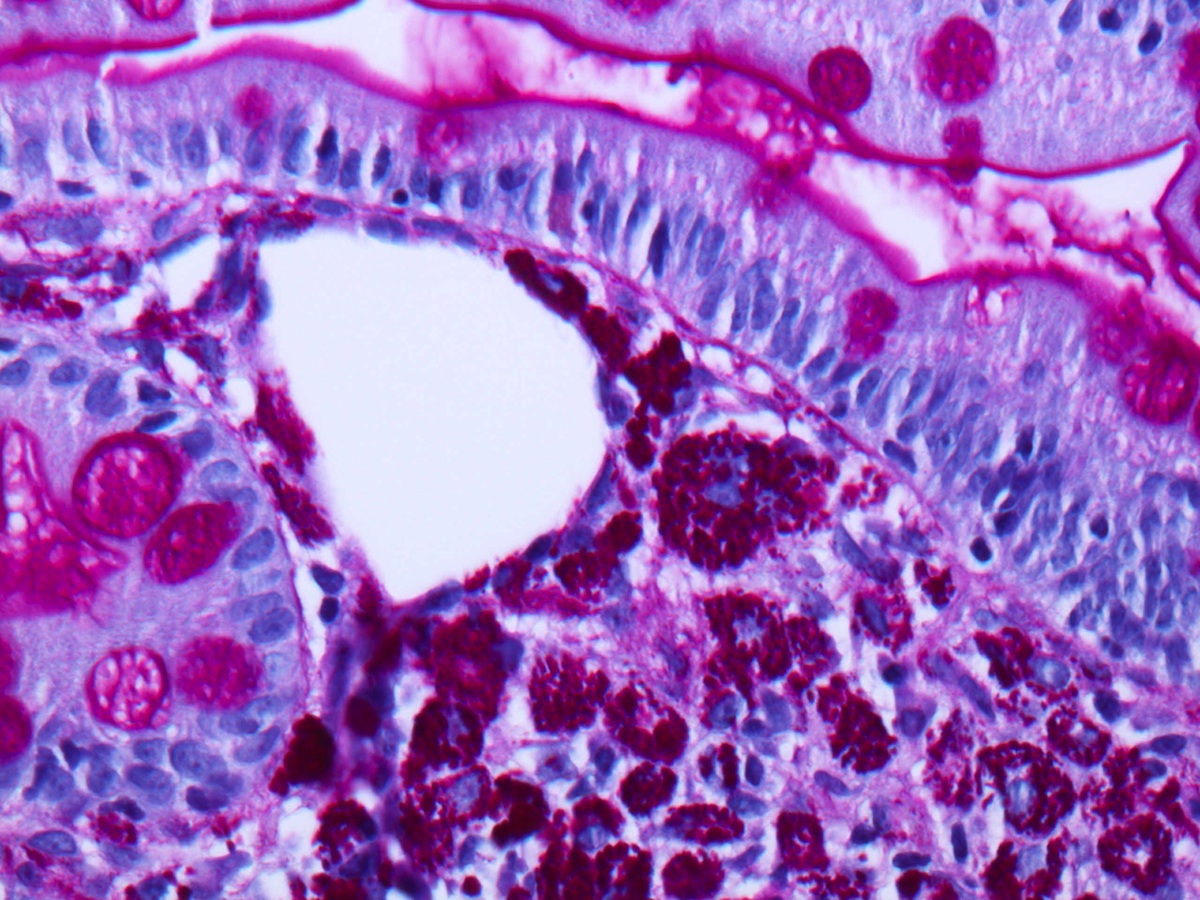 Case of the Week 303