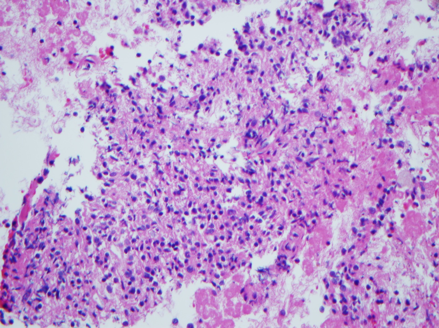 Pathology Outlines Accessory