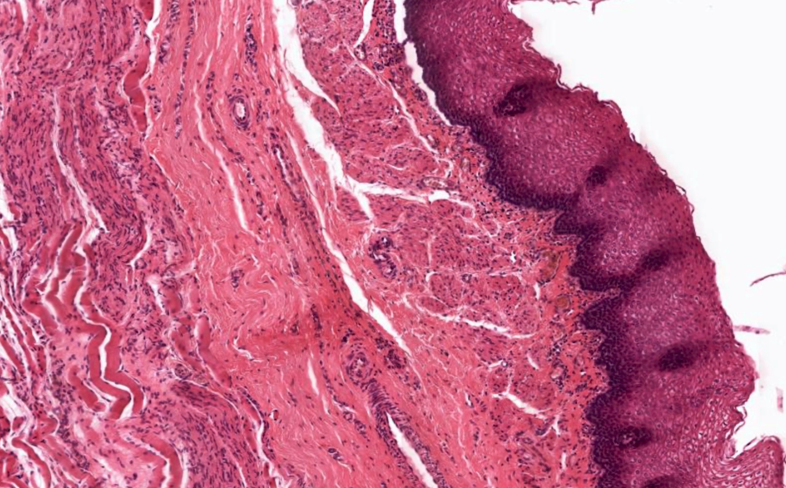 Esophageal Sphincter Histology