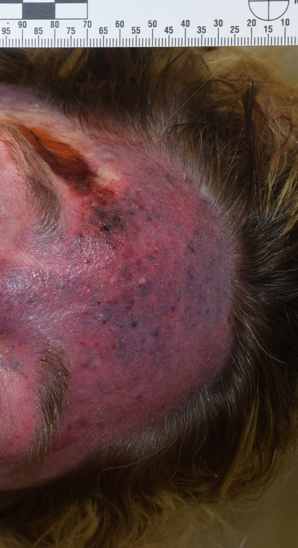 Pathology Outlines Postmortem changes