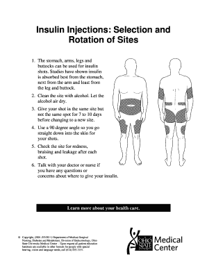 Printable Insulin Injection Site Chart - Ponasa