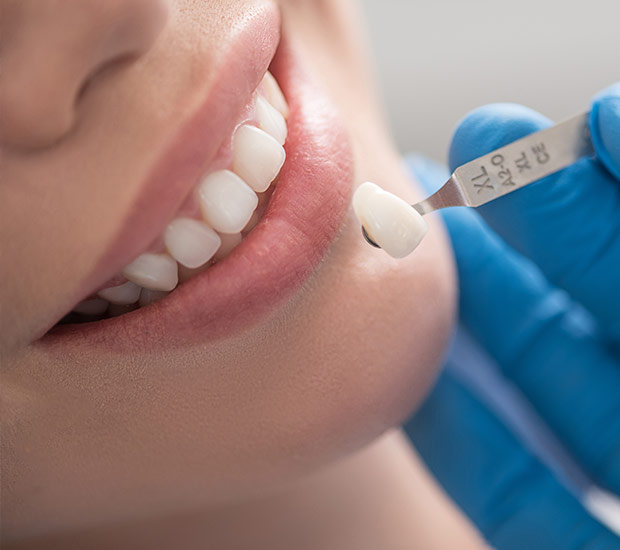 ToothColored Crowns Fun Park Pediatric Dentistry Suffolk, VA