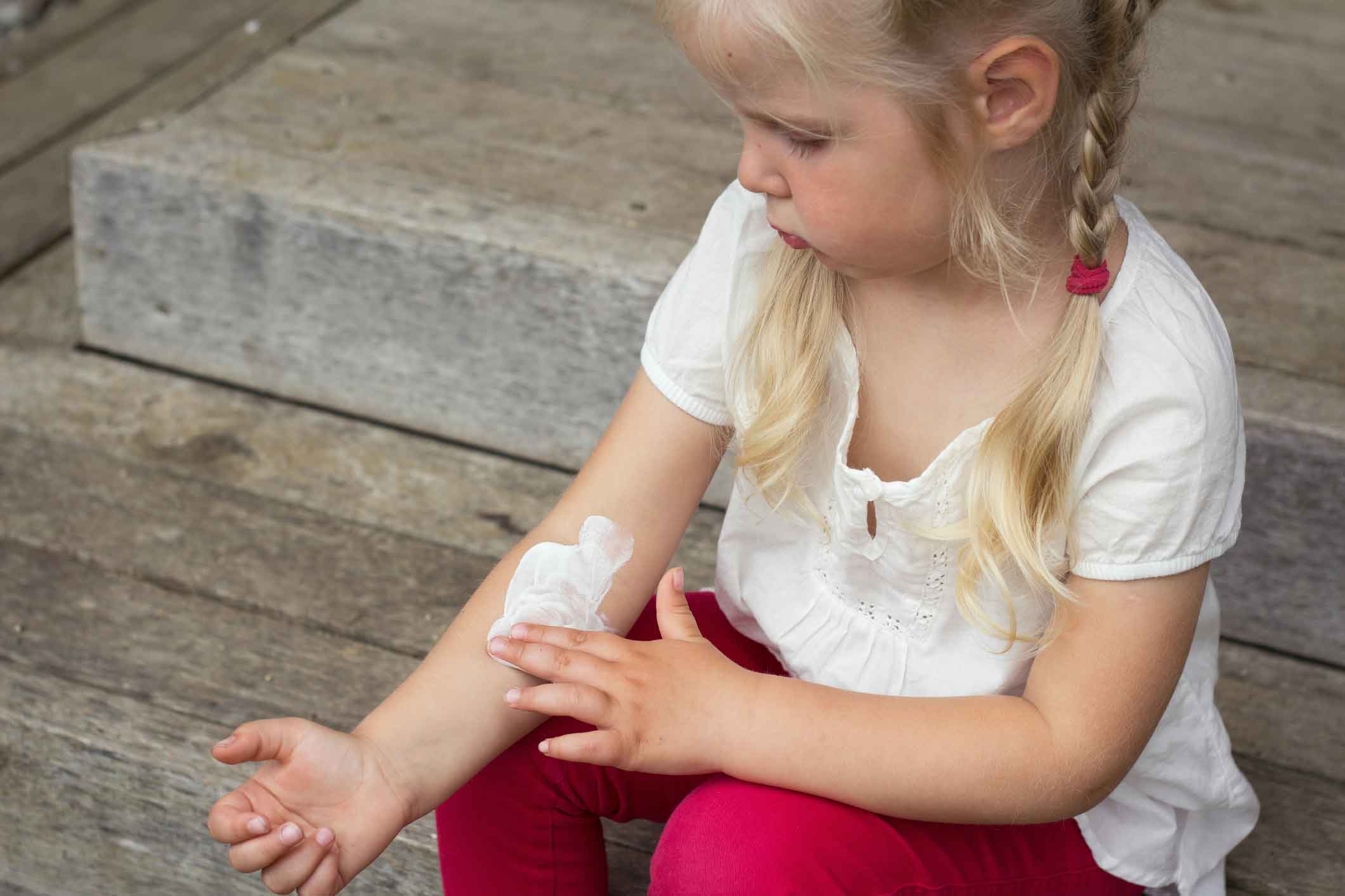 How to Treat Staph Infections in Kids Pediatric Associates of Franklin