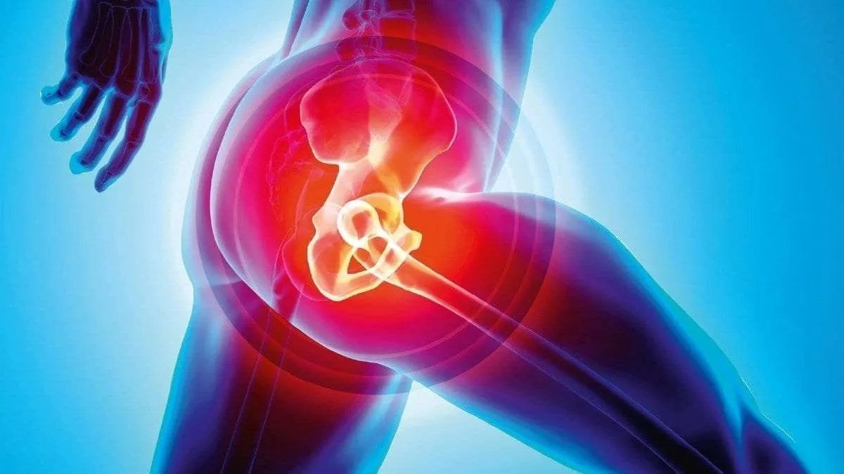Hip Replacement Physio Penrith Physiotherapy Sports Centre