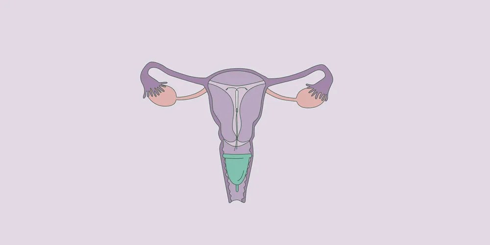Can I Use a Menstrual Cup with an IUD Period Nirvana