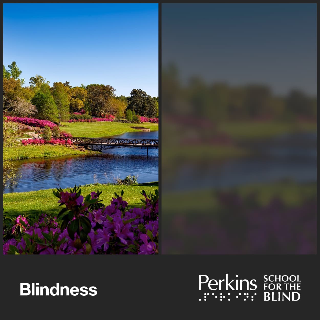 What blindness really looks like Perkins School for the Blind