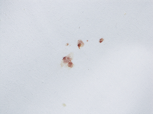 Bed Bug Signs Common Signs of Bed Bugs