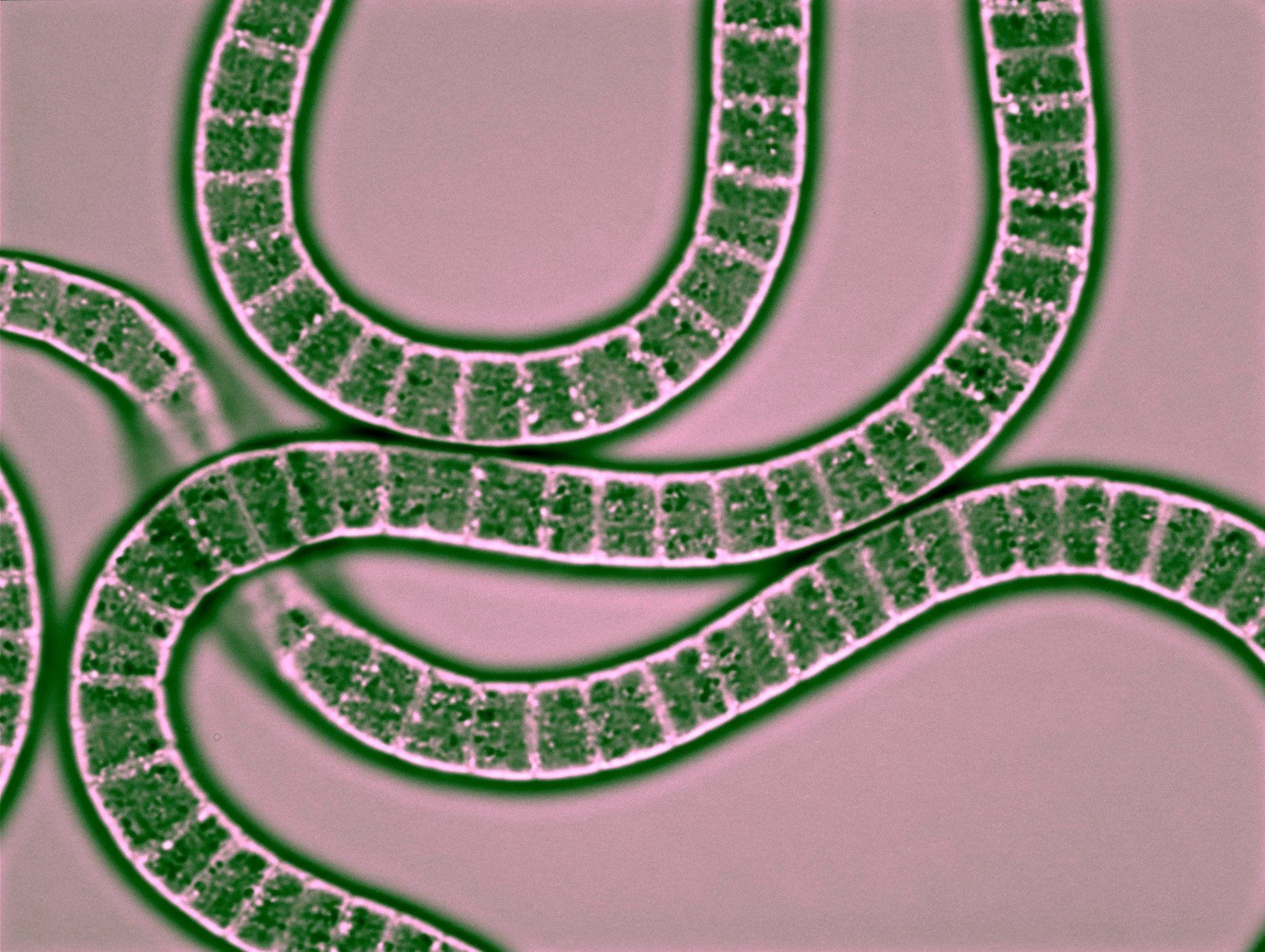 Beyond the lung treating the GI symptoms of Covid19 Pharmaceutical