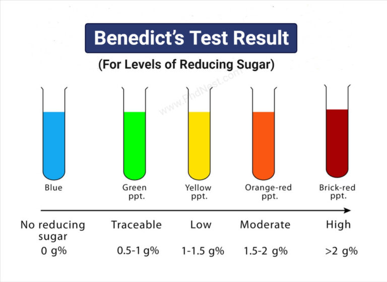 Benedict’s Test Objectives, Principle, Procedure, Results, Limitations