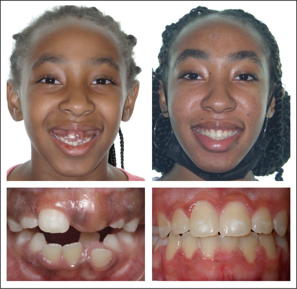 Philadelphia Orthodontist Cosmetic Dentistry in Philadelphia(014)