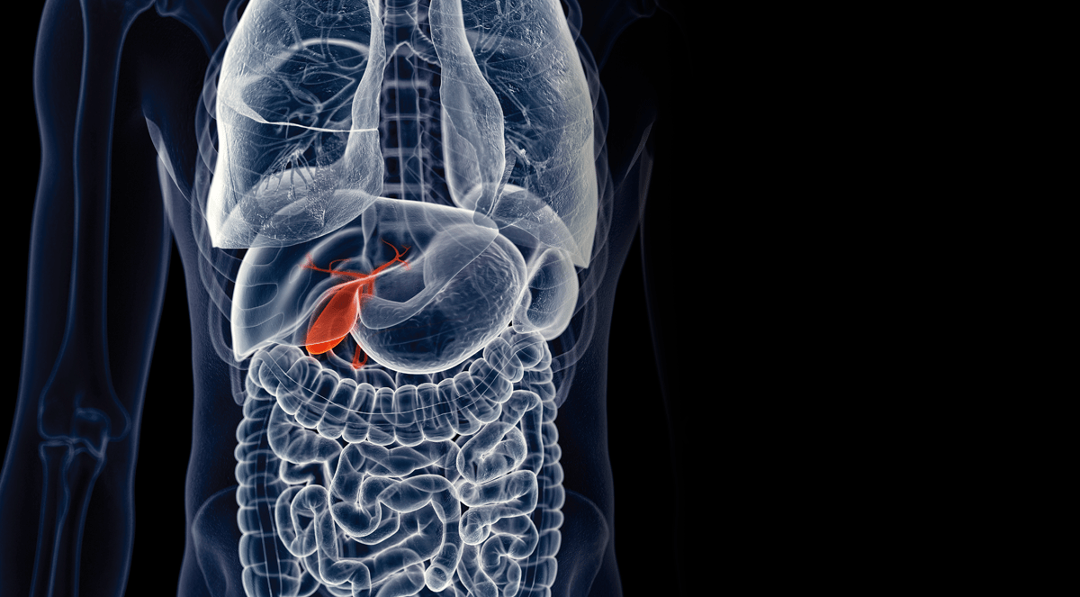 Interventions for Gallbladder Disease Physician's Weekly