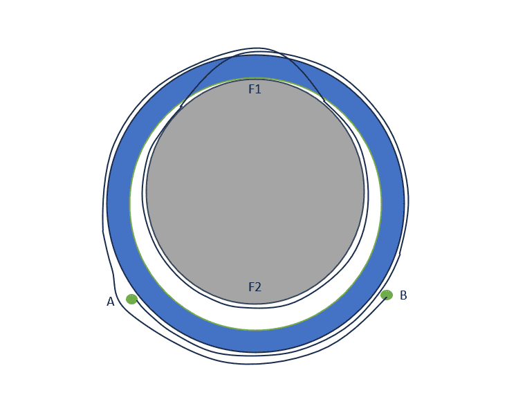Capstan Equation, Friction and Normal Force