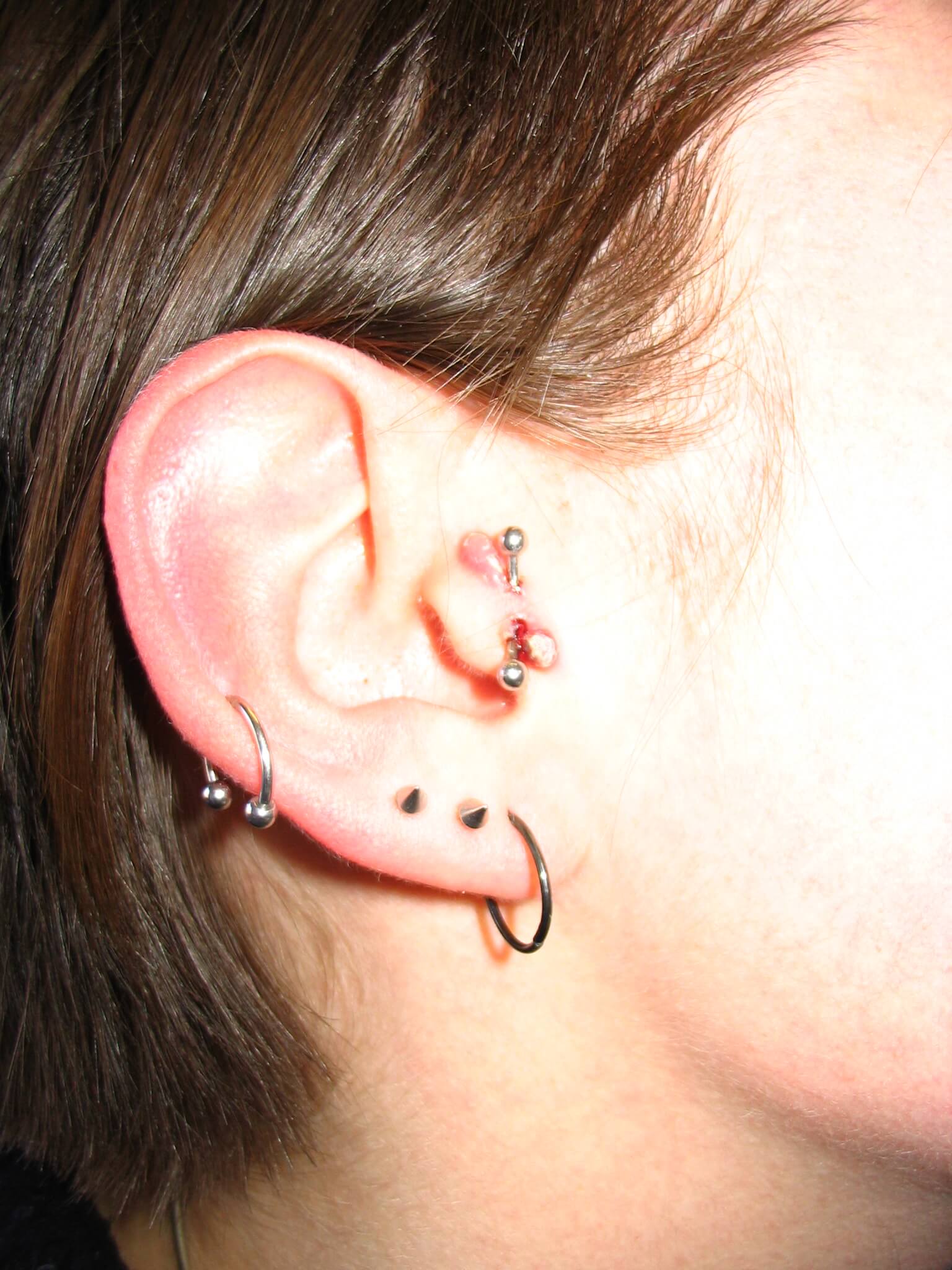 Do you love second studs? The Dreaded Piercing Rejection â¢ Piercing HQ