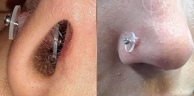 Piercing Bumps The Complete Infection and Treatment Guide (2020)