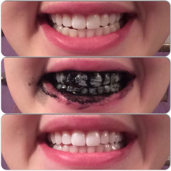 5 Surprising Beauty Uses for Activated Charcoal (Recipes included
