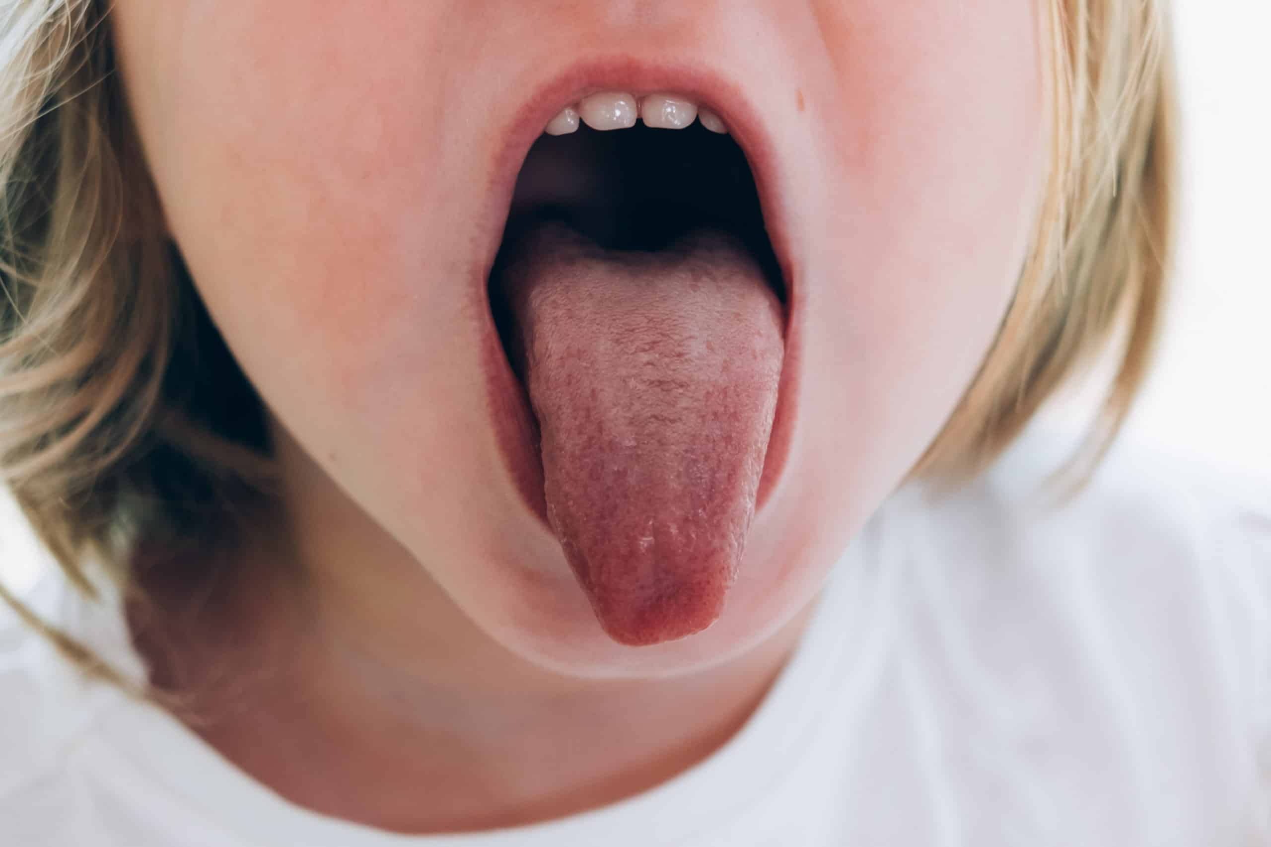 Why Does My Tongue Feel Numb or Tingling? Causes and Solutions