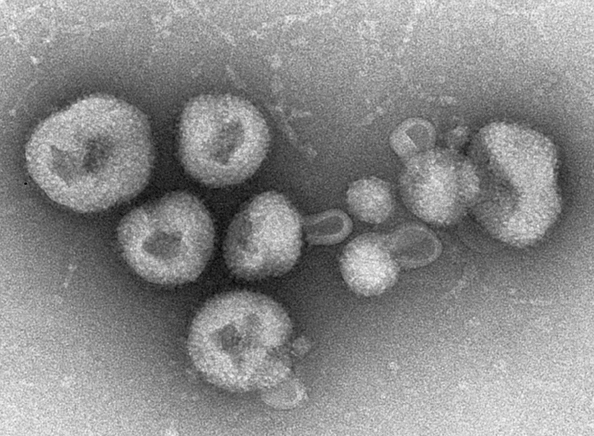 The 10 Deadliest Viruses Deadly