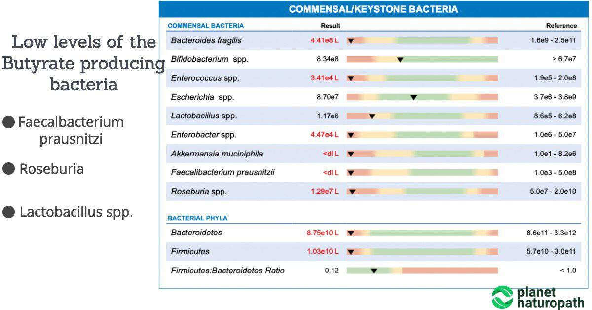 Butyrate Benefits 10 Things You Need To Know