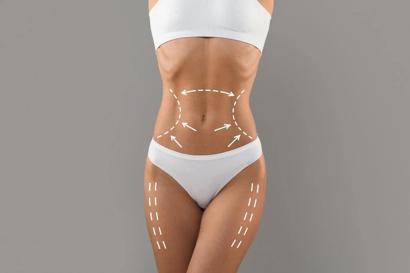 Body Jet Liposuction Pengertian, Manfaat dan Prosedurnya Plasthetic