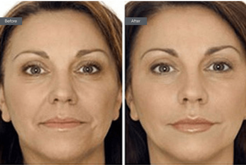 Find A Plastic Surgeon In Toronto Plastic Surgeons Toronto
