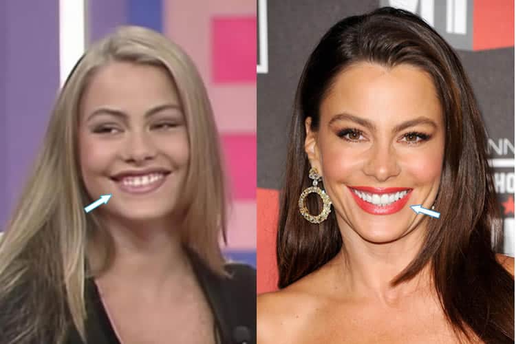 Has Sofia Vergara Had Plastic Surgery (Before & After 2021)