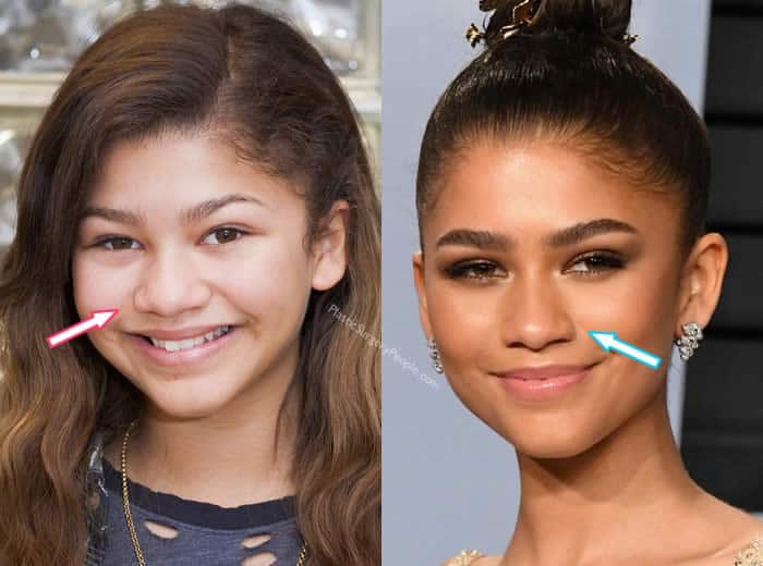Zendaya BEFORE and AFTER 2022