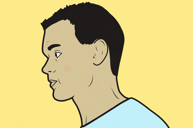 How to Pop a Pimple the Smart Way Plastic Surgery Practice