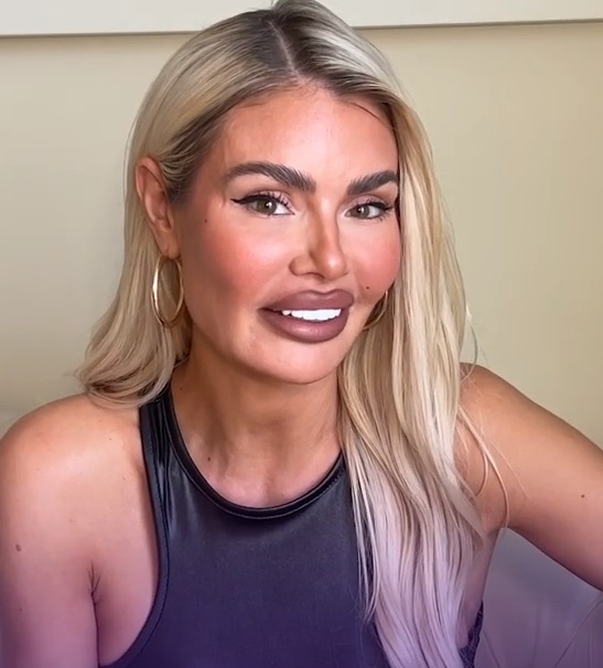 Did Chloe Sims Have Plastic Surgery? Everything You Need To Know(03)
