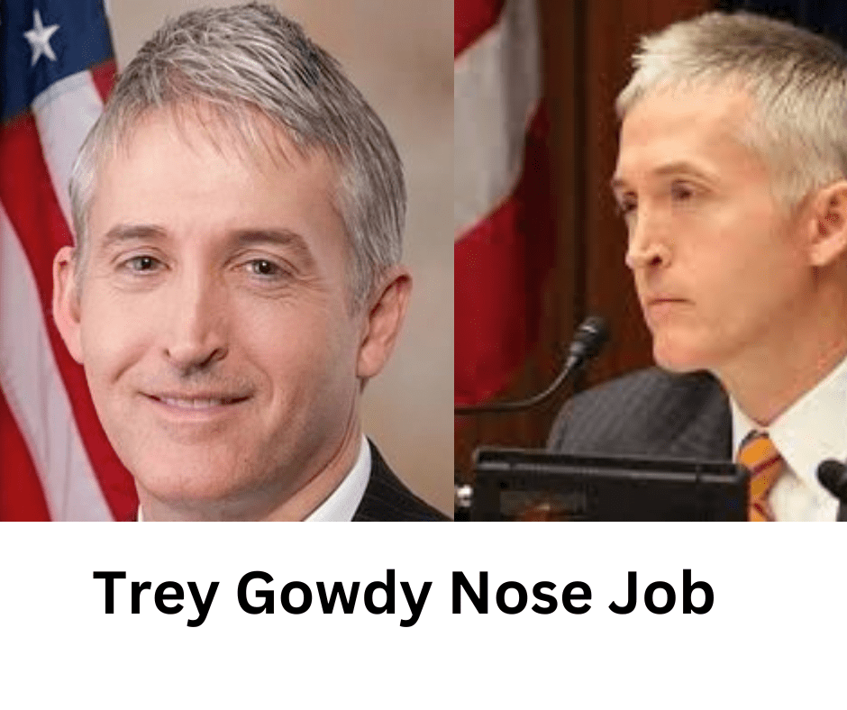 Trey Gowdy Nose Job Exploring the Truth Behind the Rumors Celebrity