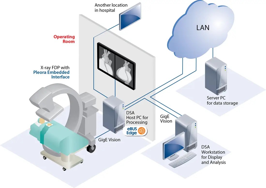 Data Transmission for XRay Systems Pleora Technologies