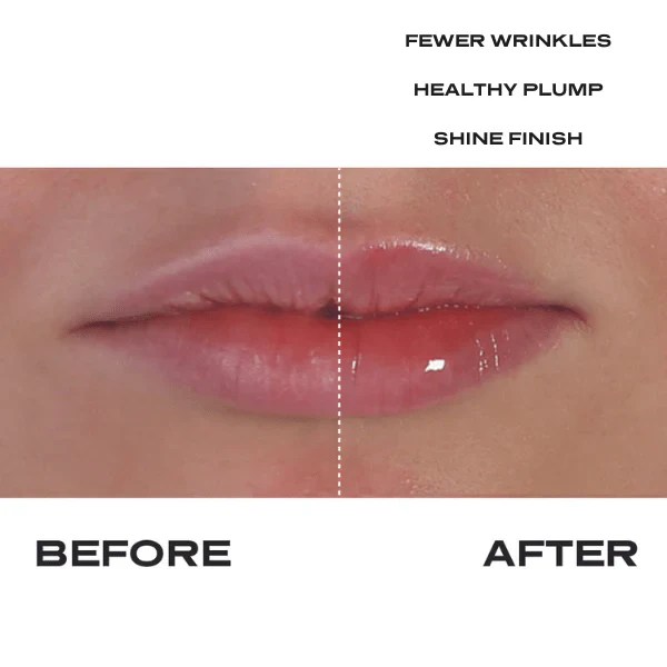 No Needles Lip Filler Kit Lip Builders LongTerm Lip Builders
