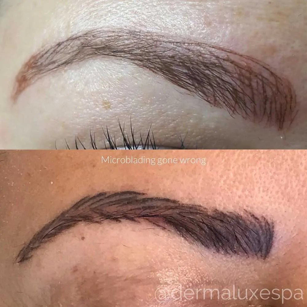 Top 6 before and after bad microblading eyebrows 2022