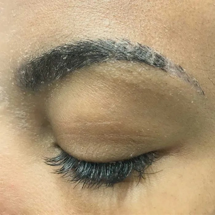 Help, I Picked My Microblading Scabs. What Do I Do Now?